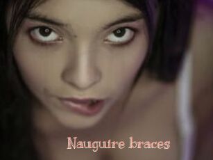 Nauguire_braces